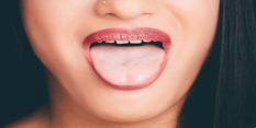 Warning over fake tongue piercings after three girls end up in hospital